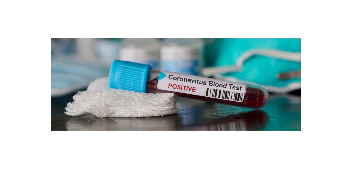 Il est « peu probable » que le vaccin contre le coronavirus soit 100% efficace en 2021 