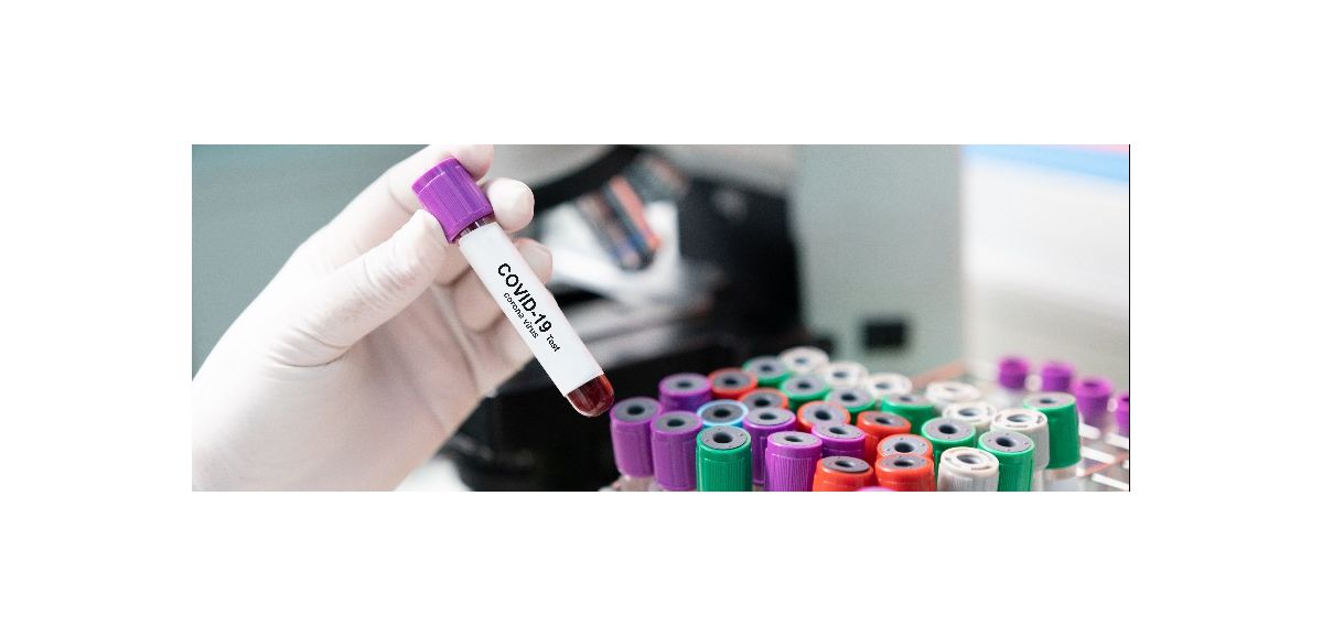 Les tests du médicament contre le Covid-19 pourraient débuter en février à l'Institut Pasteur à Lille