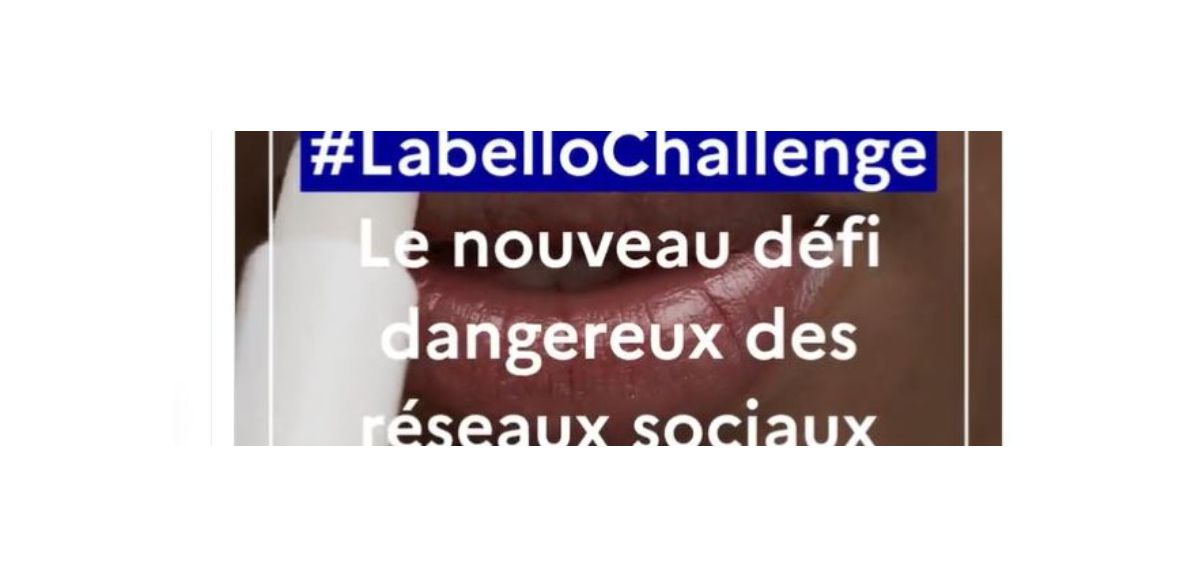 Appel à la vigilance face au « Labello challenge » sur Tik Tok